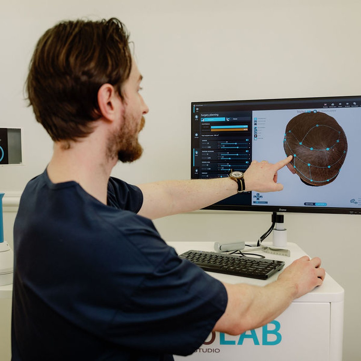 Dr Alex reviewing a patient's TrichoLAB 3D scan and hair density mapping in the clinic